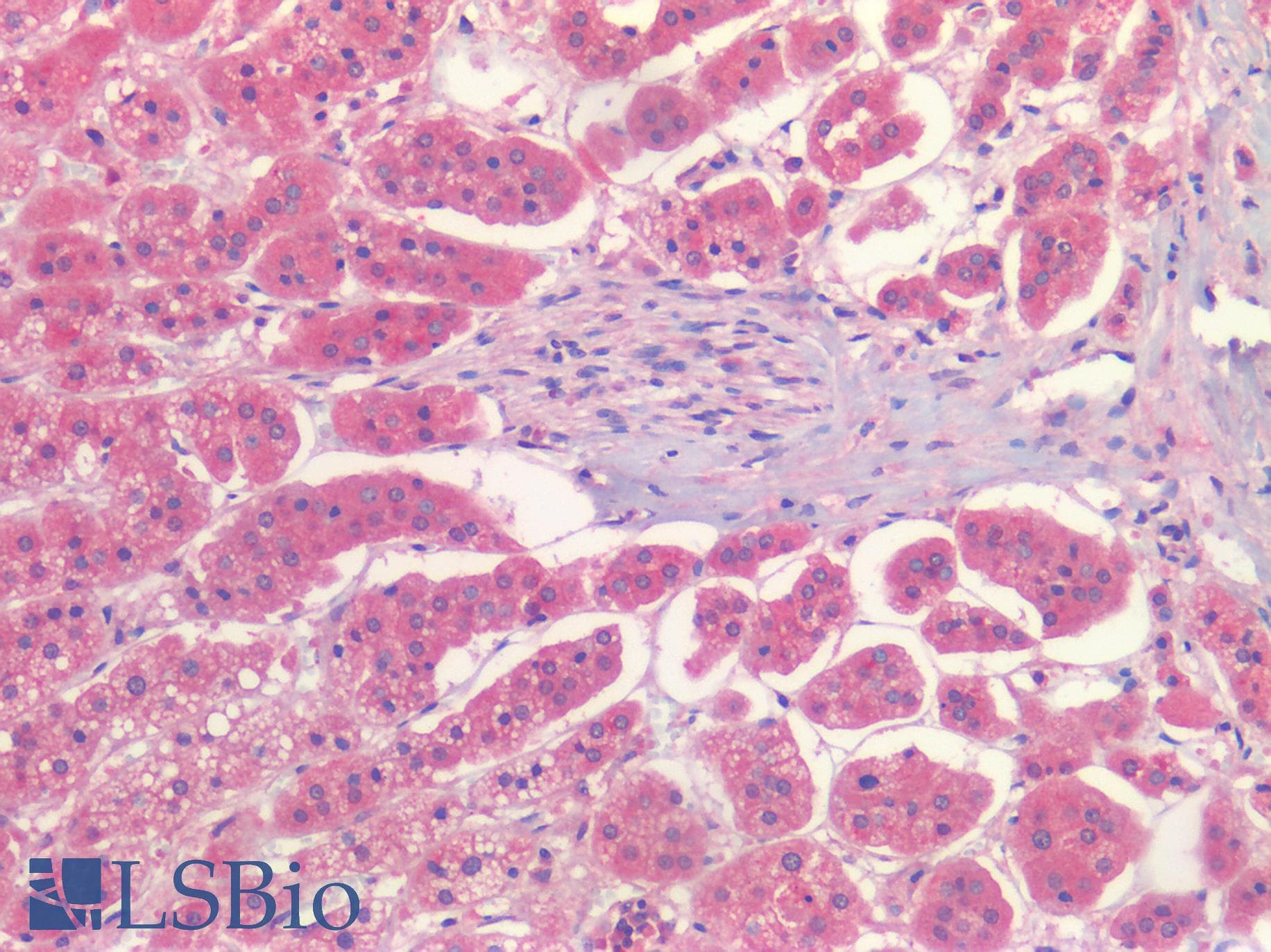 PathPlus™ TIMP2 Antibody (clone 3A4)