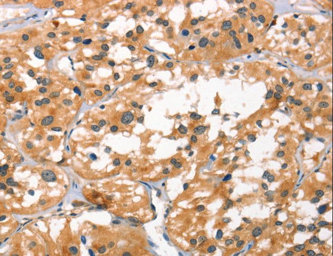 SMAD3 Antibody
