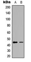 GATA1 Antibody (phospho-Ser142)