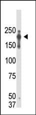 PRDM2 / RIZ1 Antibody (clone 33AT1045)
