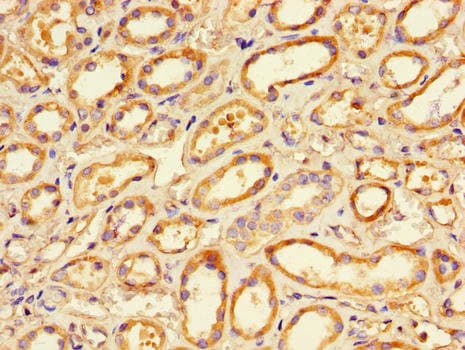 PRKCA / PKC-Alpha Antibody