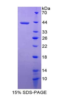 Rat MIA / CD-RAP Protein (Recombinant His-GST)