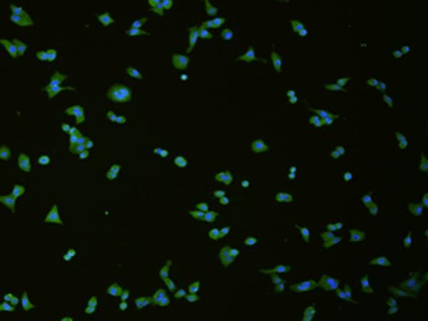 SLC18A3 / VACHT Antibody