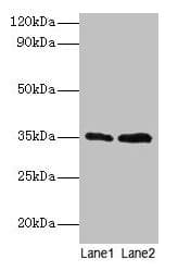 Polyclonal Rabbit anti-Human TFIIB Antibody (WB)