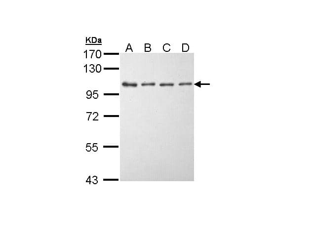 EEF2K Antibody (aa1-268)