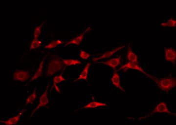 Polyclonal Rabbit anti-Human GHITM Antibody (IF, WB)