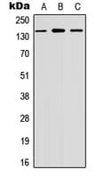 MINK1 / MINK Antibody (Internal)