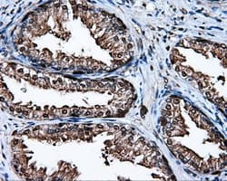 Heat Shock Protein 70 / HSPA1A Antibody (clone OTI3G9)
