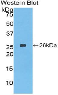 Leucine Aminopeptidase Antibody (aa320-519, Biotin)