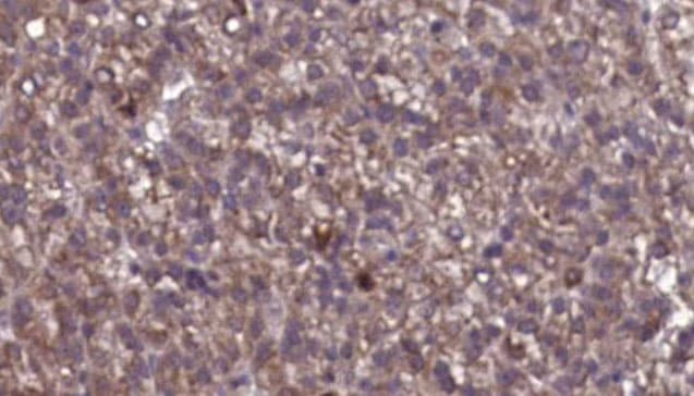Polyclonal Rabbit anti-Human GABRG2 Antibody (IHC, WB)