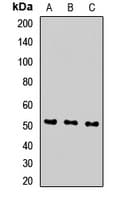 Polyclonal Rabbit anti-Human SEC61A1 / SEC61 Antibody (WB)