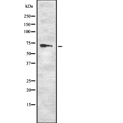 RYK Antibody