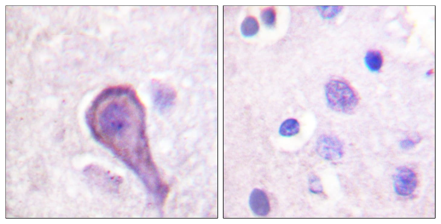 Rhodopsin / RHO Antibody (aa299-348)