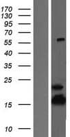 ATP5D Protein (Over-Expression Lysate Myc-DDK (Flag))