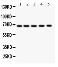 HNF1A / HNF1 Antibody (aa431-631)