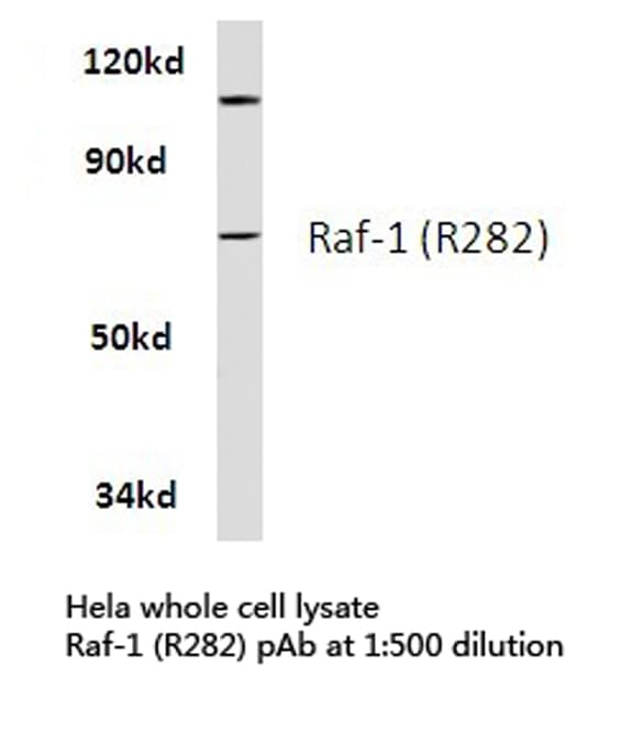 RAF1 / RAF Antibody (Arg282)