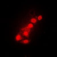 Polyclonal Rabbit anti-Human FOXO1 / FKHR Antibody (IHC, IF, WB)
