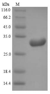 Mouse KLK8 / Kallikrein 8 Protein (Recombinant 6His, N-terminus)