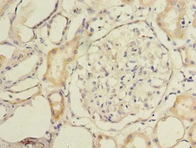 Polyclonal Rabbit anti-Human MAOA / Monoamine Oxidase Antibody (IHC, WB)