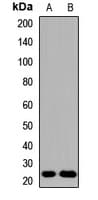 GCL / Grancalcin Antibody