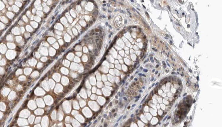 TAPBP / Tapasin Antibody