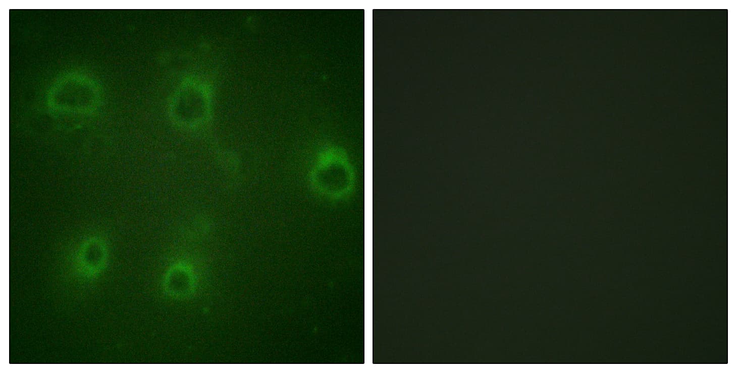 Polyclonal Rabbit anti-Human CXCR2 Antibody (phospho-Ser347, IHC, IF, WB)