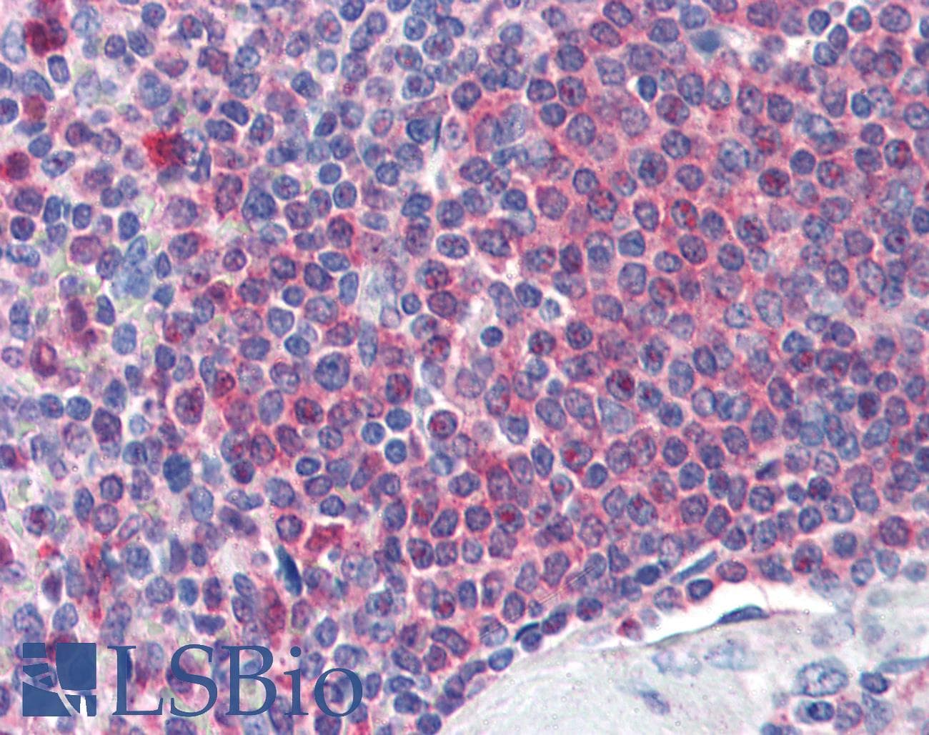 IHC-plus™ CAT / Catalase Antibody (aa498-511)