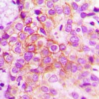 CTNND1 / p120 Catenin Antibody (phospho-Tyr228)