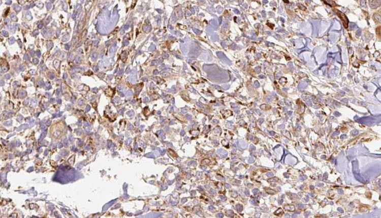 IL24 Antibody