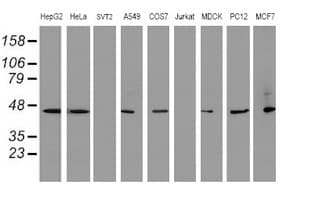SERPINB1 Antibody (clone OTI3B4)