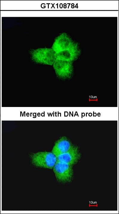 Polyclonal Rabbit anti-Human Alpha Tubulin Antibody (aa118-365, IHC, WB)