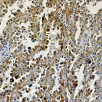 CA9 / Carbonic Anhydrase IX Antibody