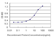 IHC-plus™ Monoclonal Mouse anti-Human DARS Antibody (clone 2F11, IHC, WB)