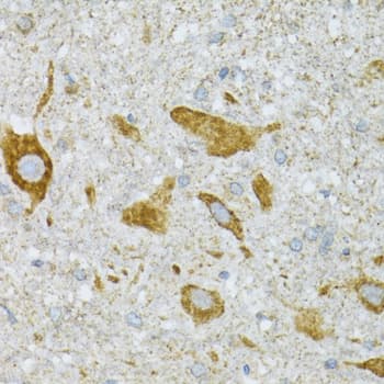 ST3GAL3 / ST3N Antibody
