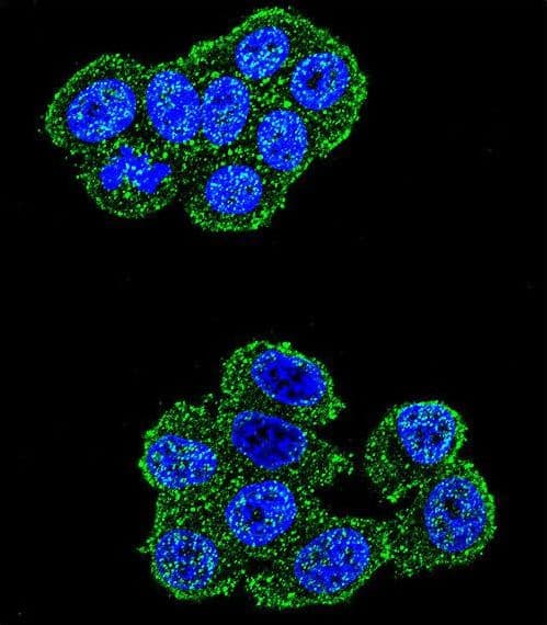 IHC-plus™ UQCRFS1 Antibody (aa181-209)