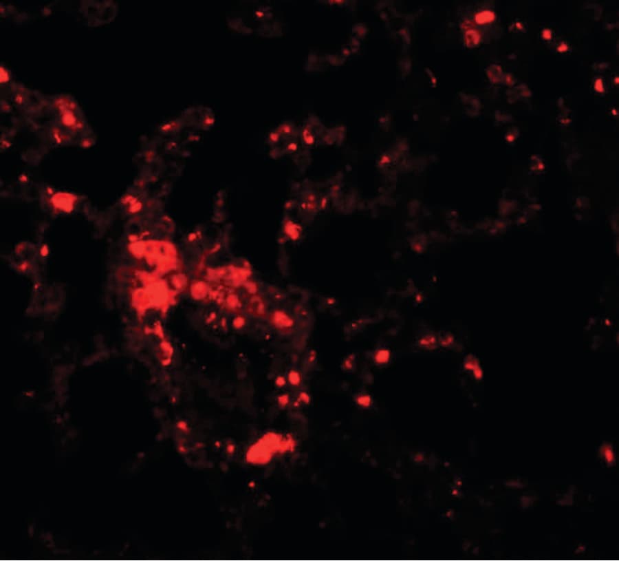 SLC39A6 / LIV-1 Antibody