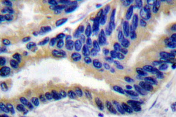 CASP3 / Caspase 3 Antibody