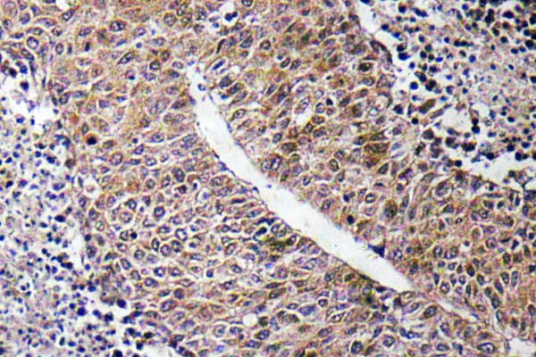 CTPS Antibody (Lys109)