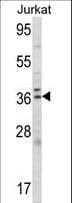 ALAD Antibody (aa244-272)