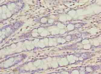 FAM222B Antibody