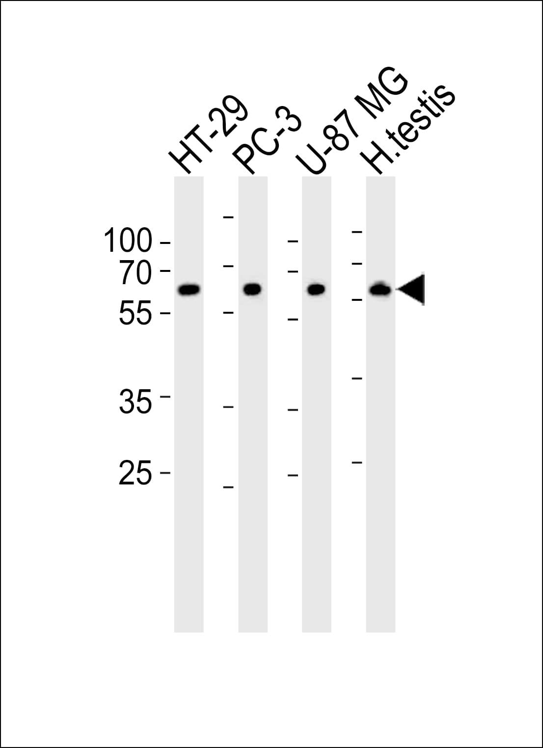 OASL Antibody (aa484-514)