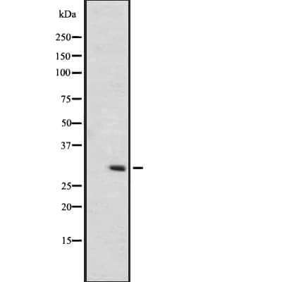 OR6C75 Antibody