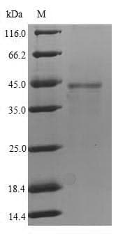 Human FCRL4 / IRTA1 / CD307d Protein (Recombinant 6His, N-terminus)