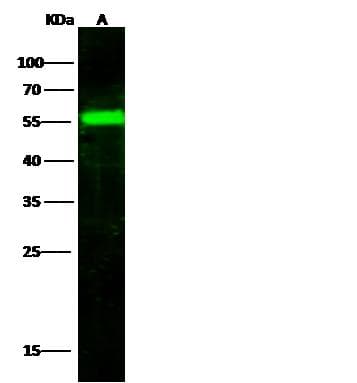 F9 / Factor IX Antibody (Preservative Free)