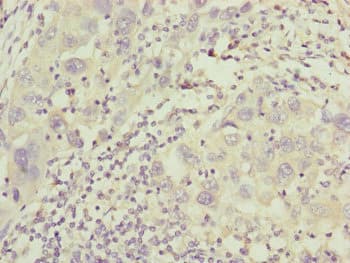 Polyclonal Rabbit anti-Human IFT20 Antibody (IHC, WB)
