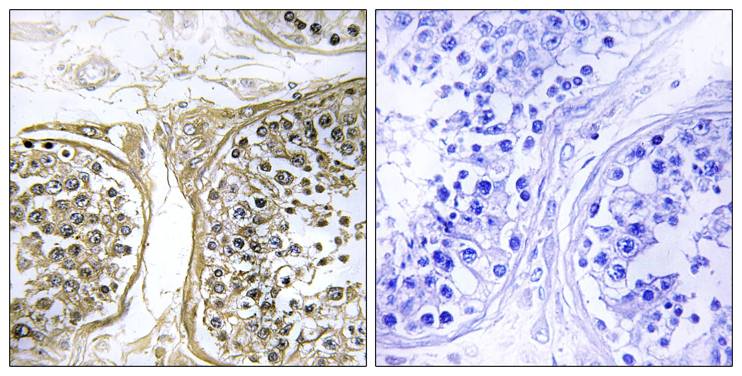 CYP2C8 Antibody (aa241-290)