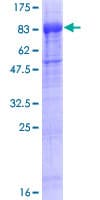 Human STKLD1 / SgK071 Protein (Recombinant GST)