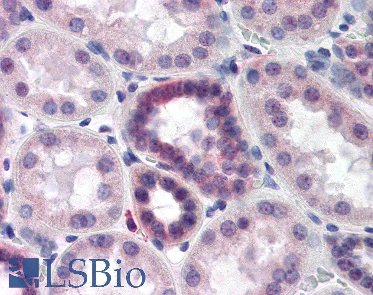 IHC-plus™ CAND2 / TIP120B Antibody (aa1130-1143)
