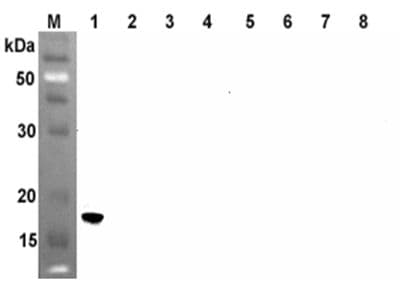 IHC-plus™ ANGPTL4 Antibody (Coiled-coil domain, clone Kairos4-397G)
