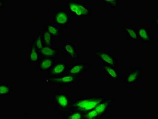 Polyclonal Rabbit anti-Human C10orf32 Antibody